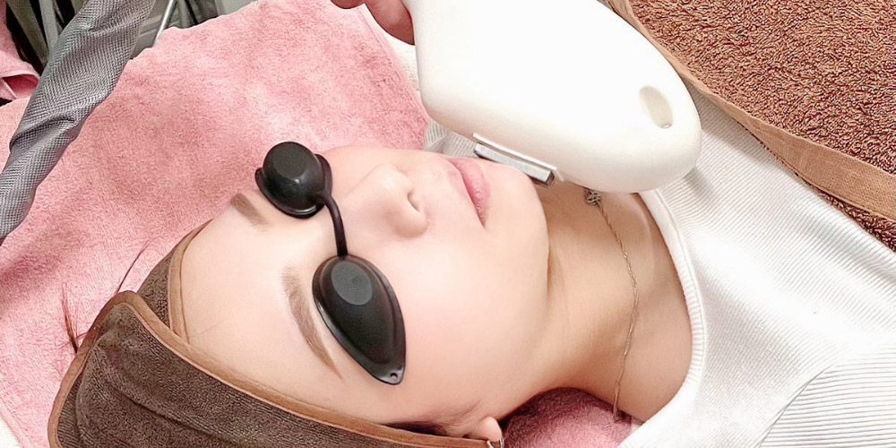 フォトフェイシャル注意事項